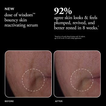 dose of wisdom<sup>™</sup> bouncy skin reactivating serum