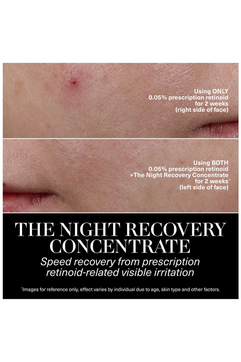 Night Recovery Concentrate, Alternate, color, NO COLOR