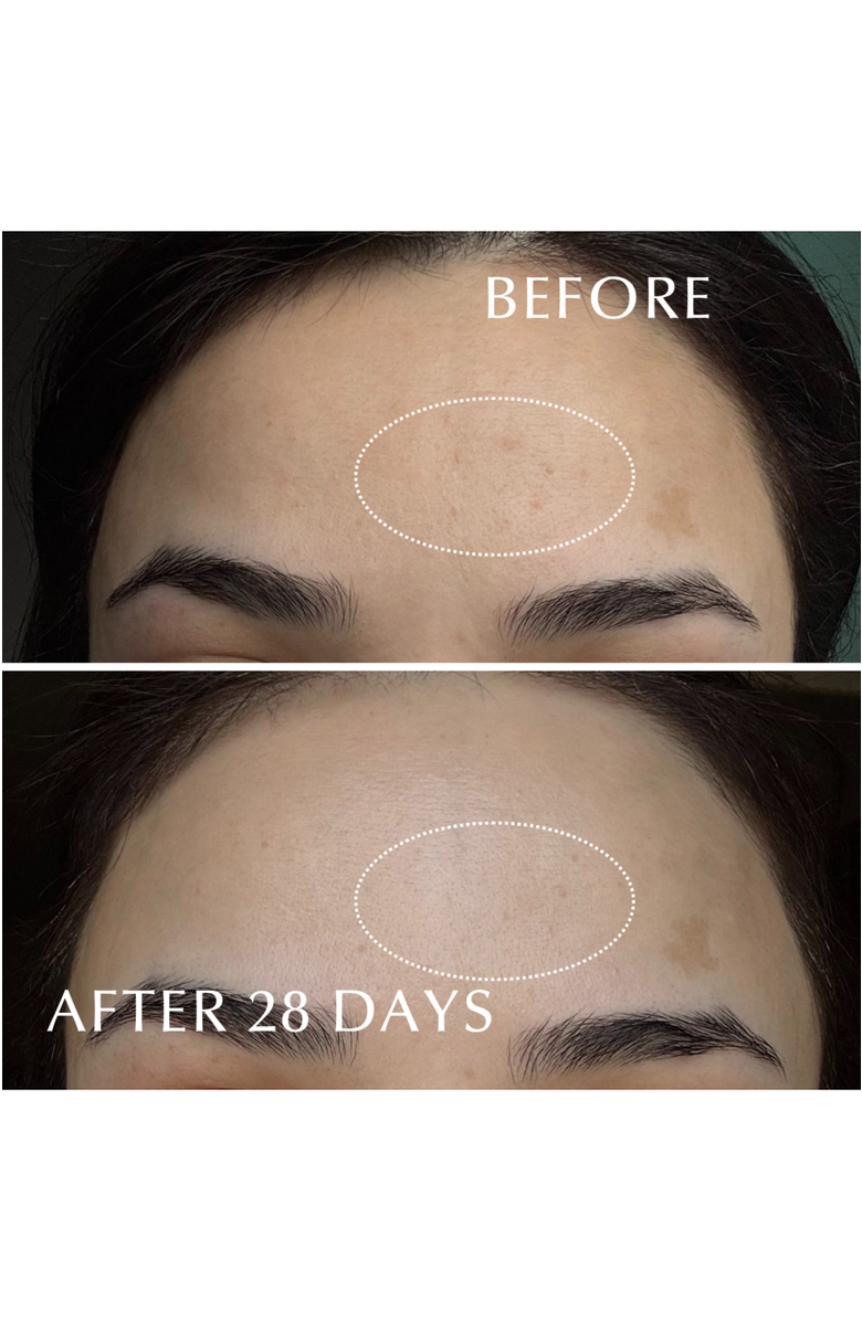 ALBION EXCIA Brightening Immaculate Serum, Alternate, color, 1.5Ml X 28