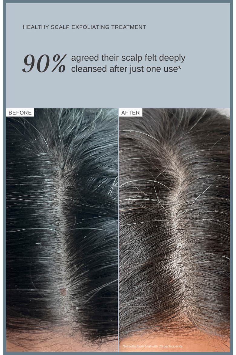 Healthy Exfoliating Scalp Treatment, Alternate, color, None