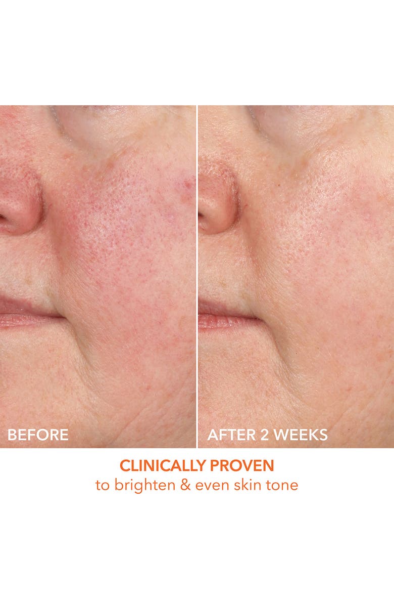 Dr. Dennis Gross Skincare Vitamin C Lactic 15% Firm & Bright Serum, Alternate, color, 