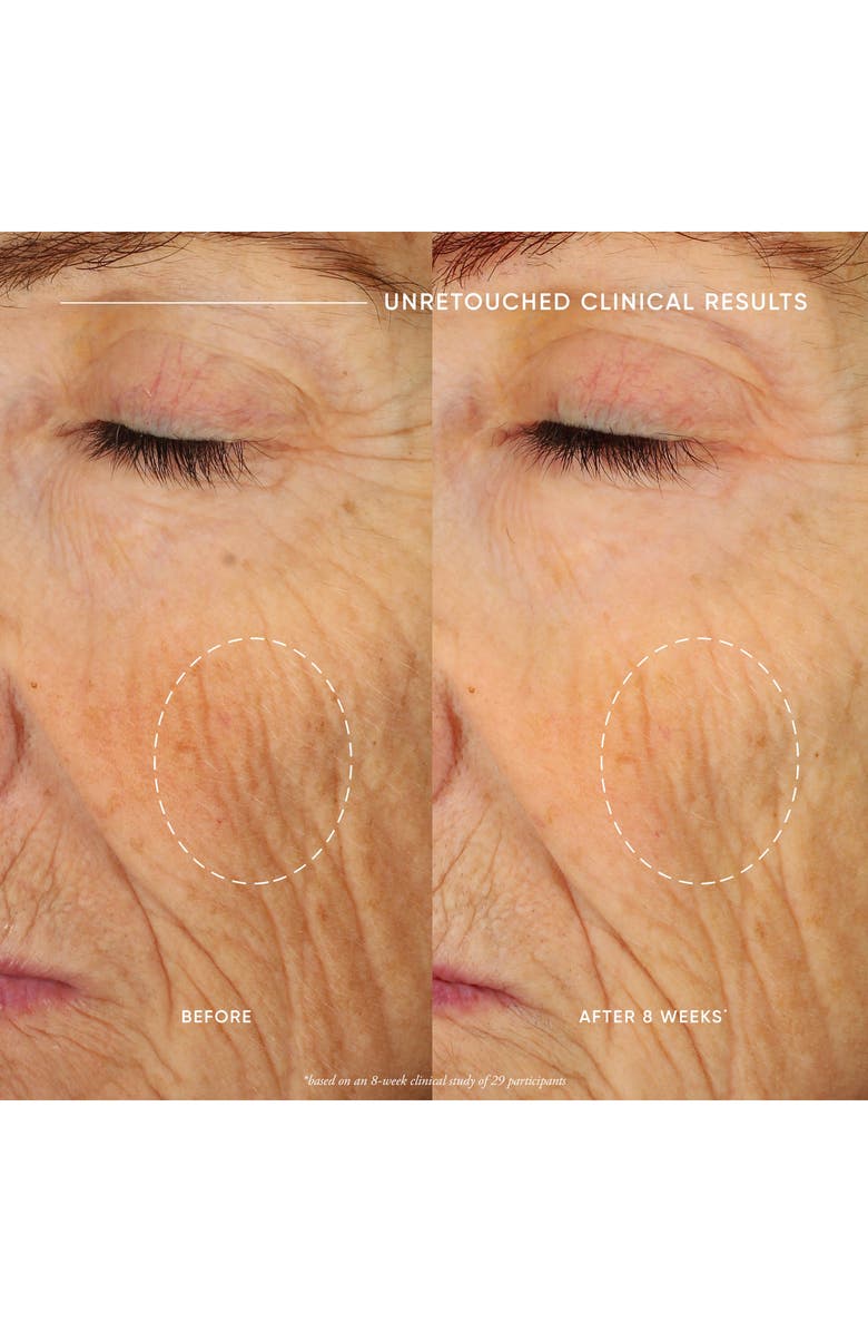 philosophy ultimate miracle worker nourish & rejuvenate face & neck cream, Alternate, color, 