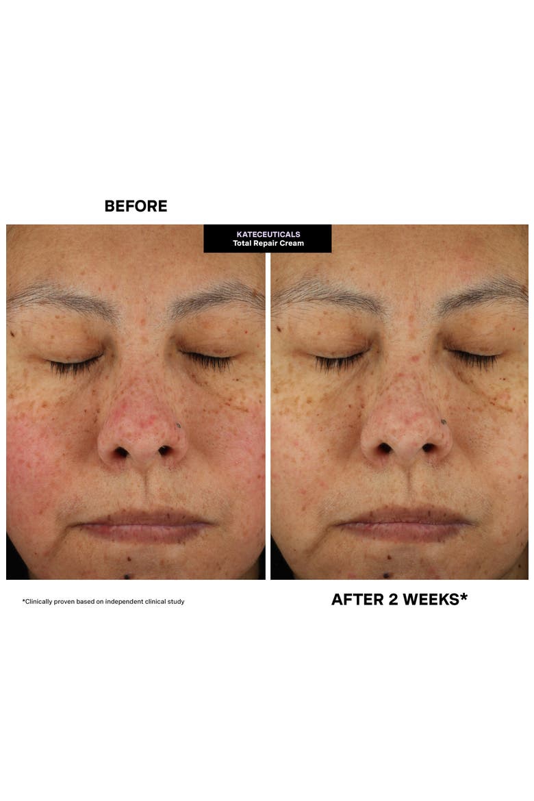 Kateceuticals® Total Repair Cream, Alternate, color, NO COLOR