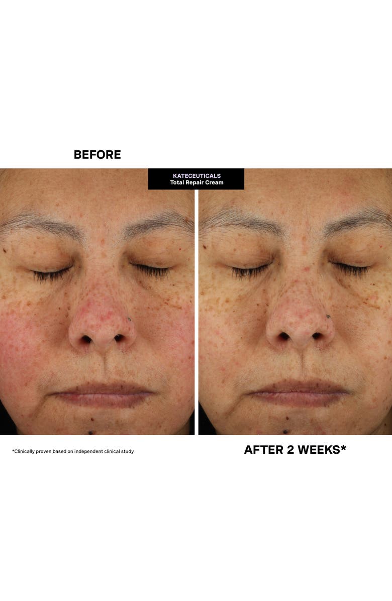 Kate Somerville<sup>®</sup> Kateceuticals<sup>®</sup> Total Repair Cream, Alternate, color, 