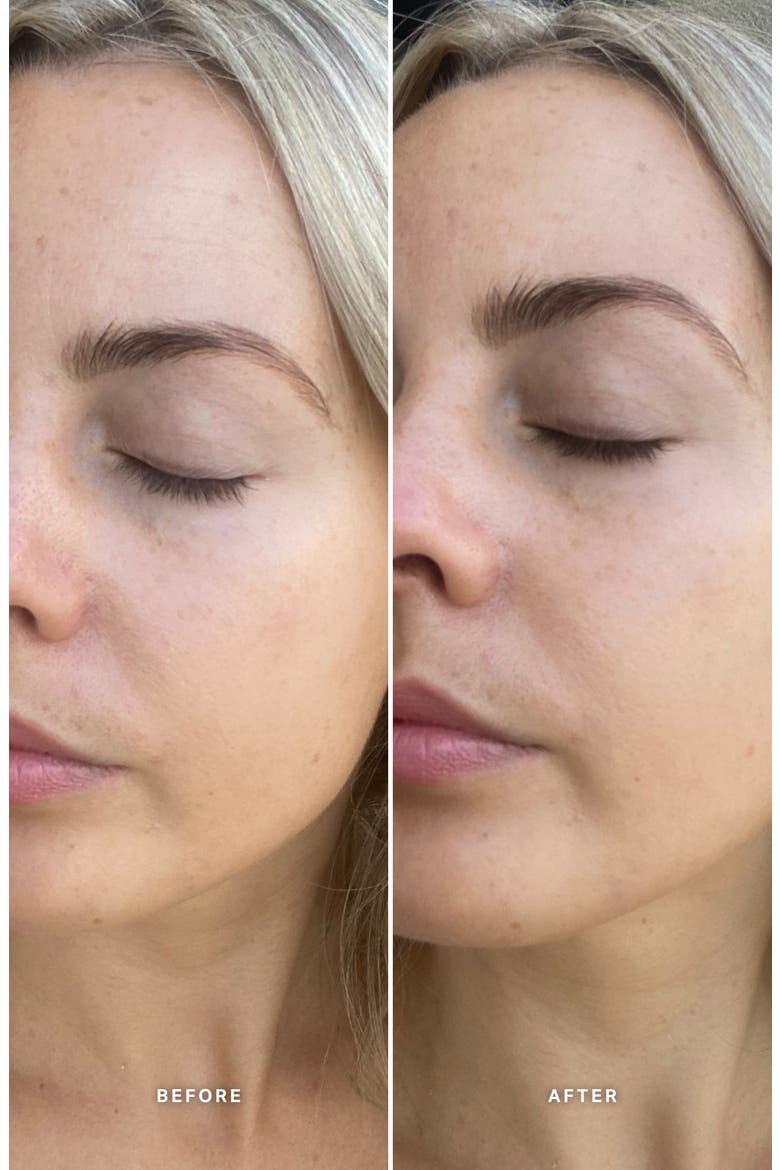 Vitamin E Serum with 1% Ceramide Complex, Alternate, color, NONE