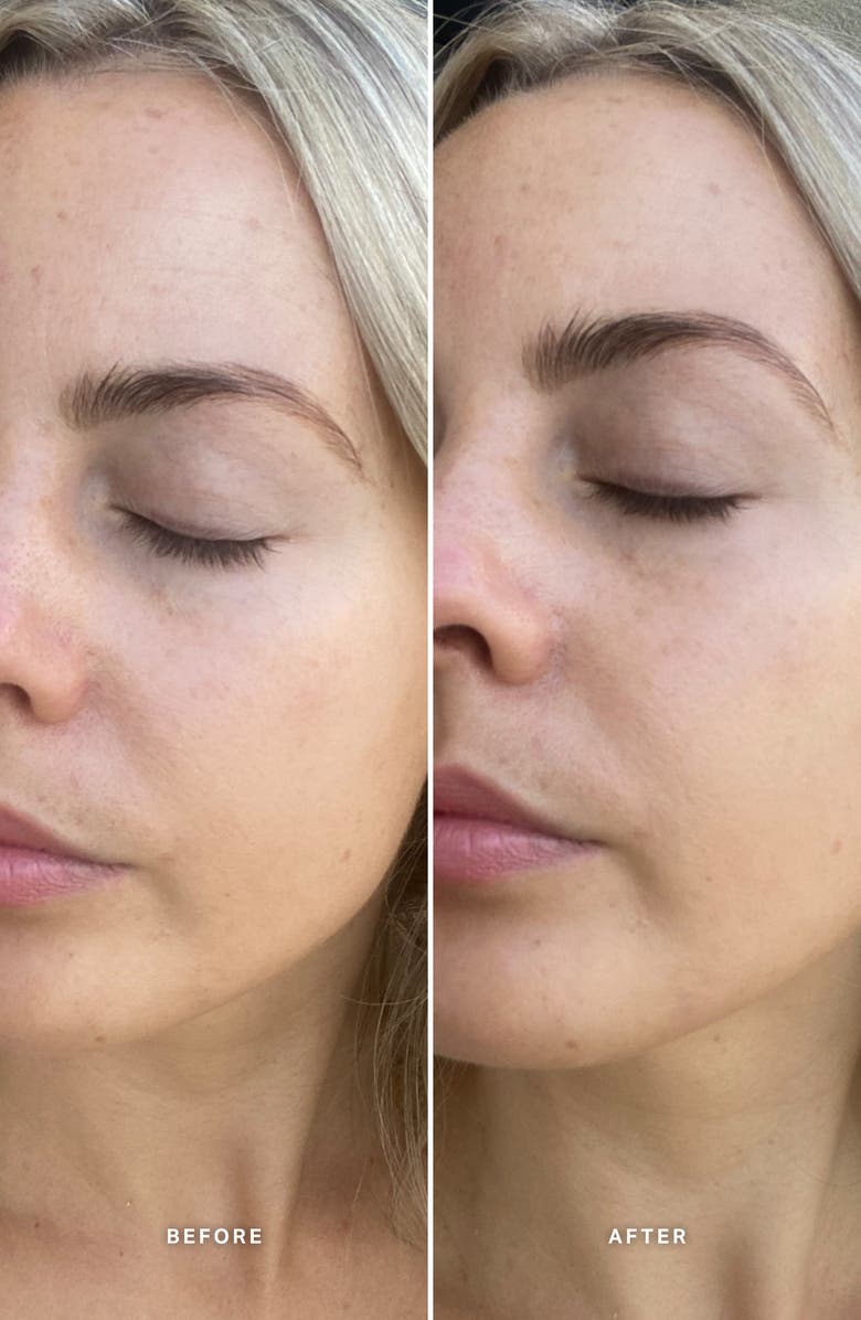 Alpha-H Vitamin E Serum with 1% Ceramide Complex, Alternate, color, 