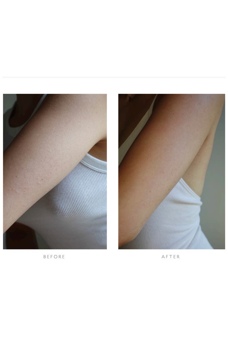 Resurfacing Body Serum, Alternate, color, NO COLOR