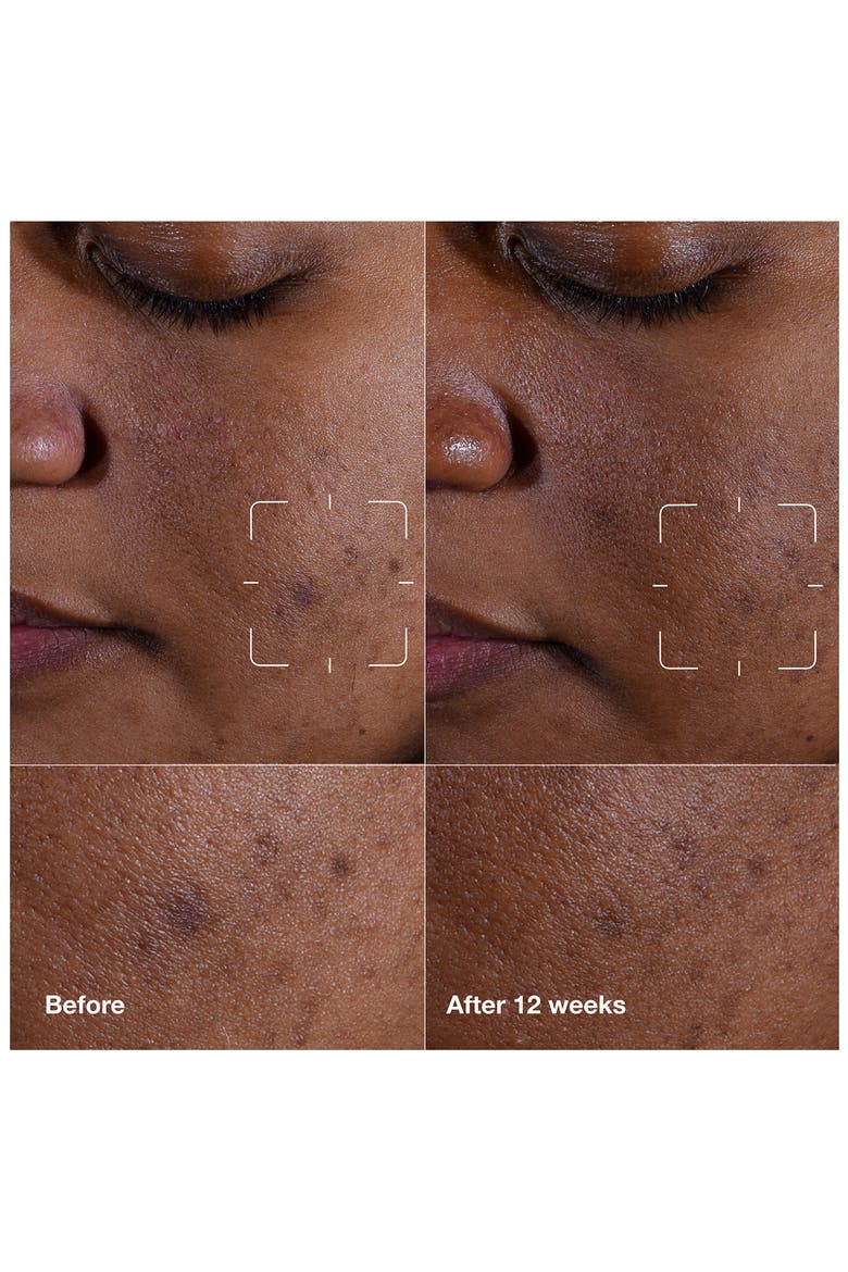 Even Better Clinical™ Dark Spot Clearing Serum, Alternate, color, NO COLOR