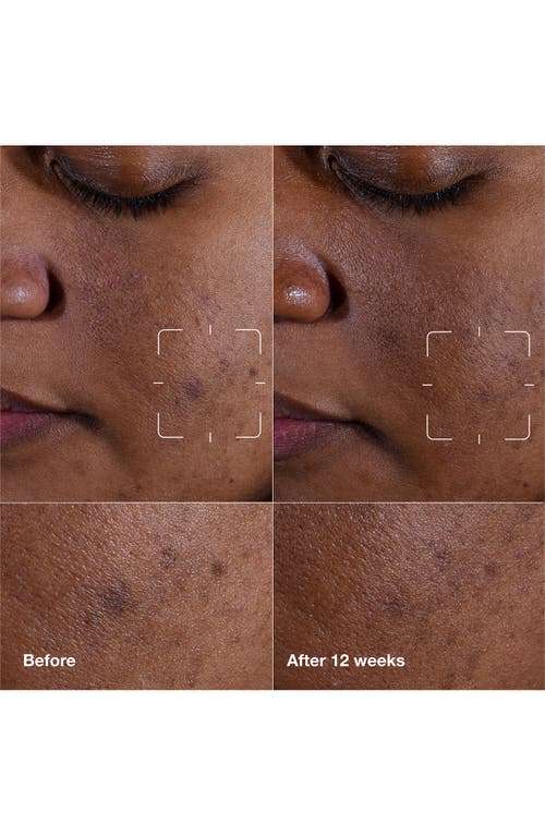 Clinique Even Better Clinical™ Dark Spot Clearing Serum In No Color