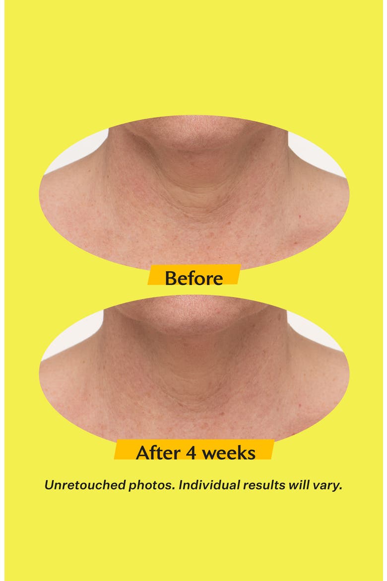 TL Advanced Tightening Neck Cream Light, Alternate, color, NO COLOR
