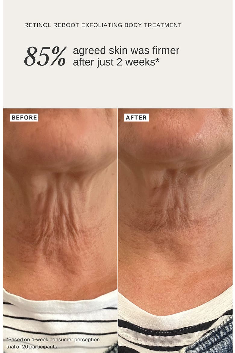 Retinol Reboot Exfoliating Body Treatment with 8% Glycolic Acid, 2% Lactic Acid+ & 1% Encapsulated Retinol, Alternate, color, NO COLOR