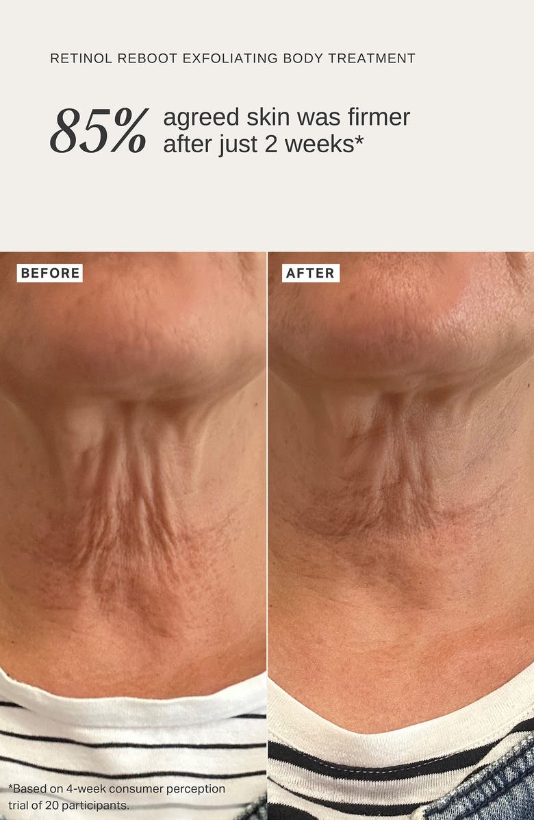 Alpha-H Retinol Reboot Exfoliating Body Treatment with 8% Glycolic Acid, 2% Lactic Acid+ & 1% Encapsulated Retinol, Alternate, color, 