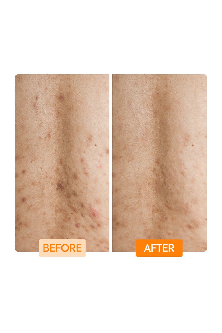 Glycolic + Lactic Acid + Niacinamide Body Wash, Alternate, color, None