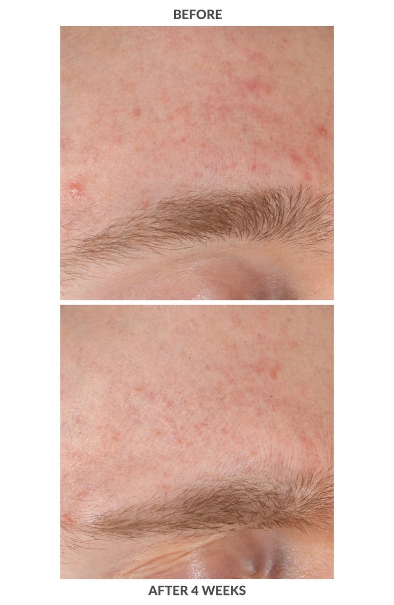 Kate Somerville<sup>®</sup> EradiKate<sup>®</sup> Salicylic Acid Overnight Acne Treatment Lotion, Alternate, color,