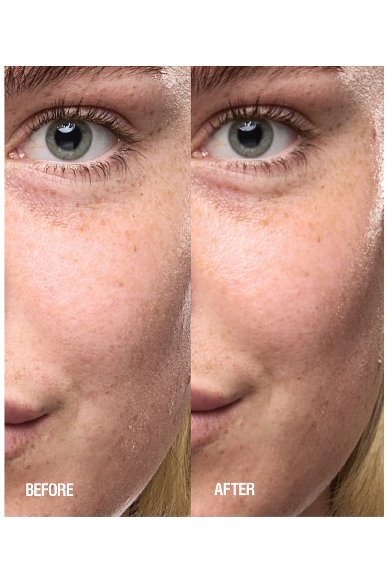 Skin Renewal Serum with Niacinamide, Vitamin E & Ashwagandha, Alternate, color, NO COLOR