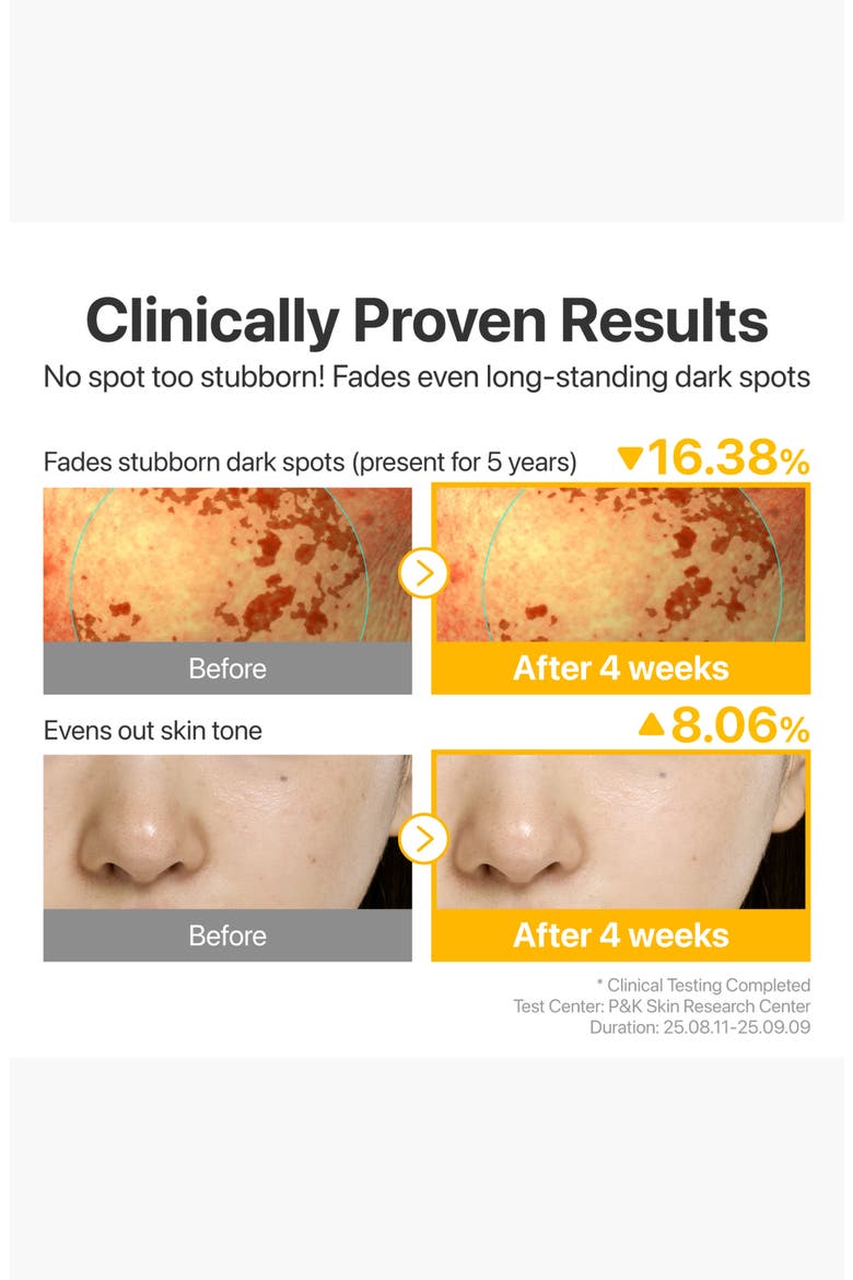 can glutathione remove dark spots No.5 Glutathione TXA Advanced Dark Spot Ampoule Concentrate (Women)