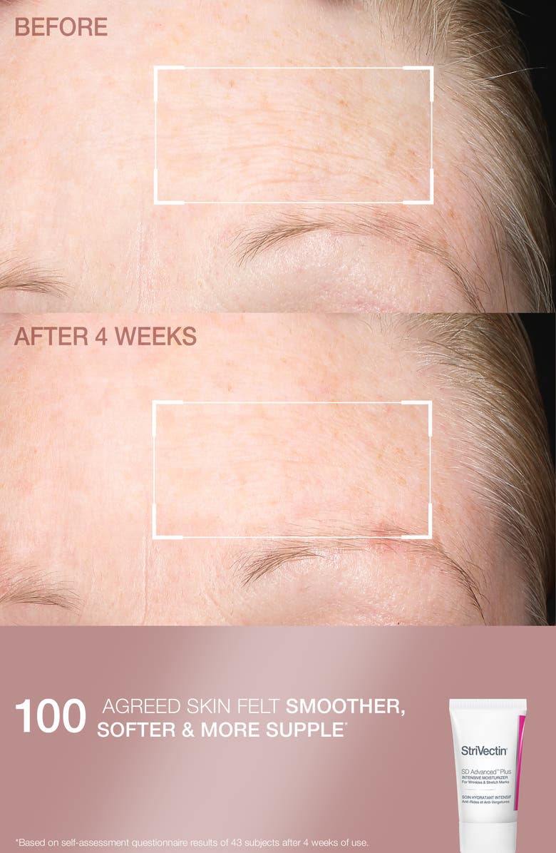 StriVectin<sup>®</sup> Smooth & Hydrate Skin Care Set $154 Value, Alternate, color, 