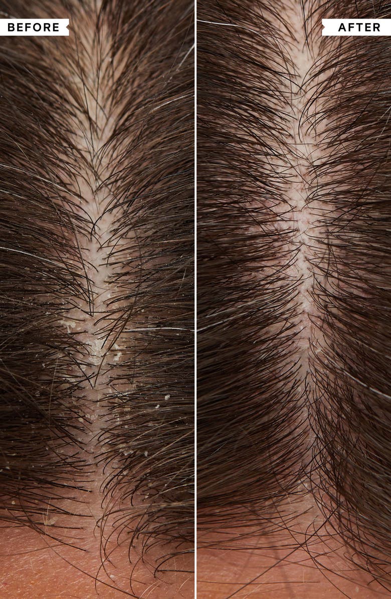 Philip Kingsley Flaky Scalp Calming Scalp Mask, Alternate, color, 