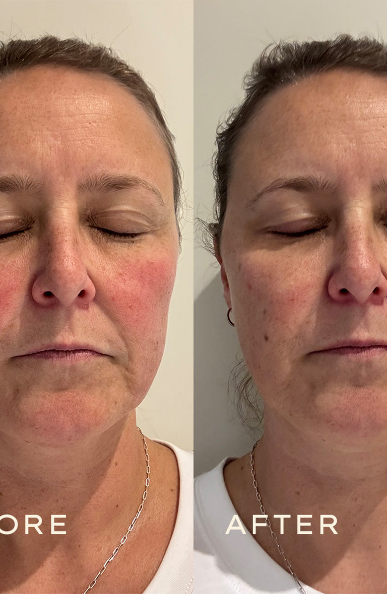 JURLIQUE Calendula Serum, Alternate, color, NO COLOR