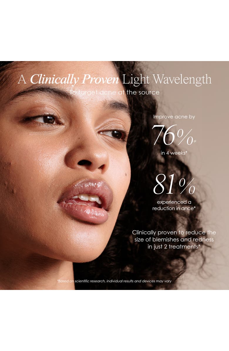 Project E Beauty Blue LED+ Acne Light Therapy Wand, Alternate, color, White