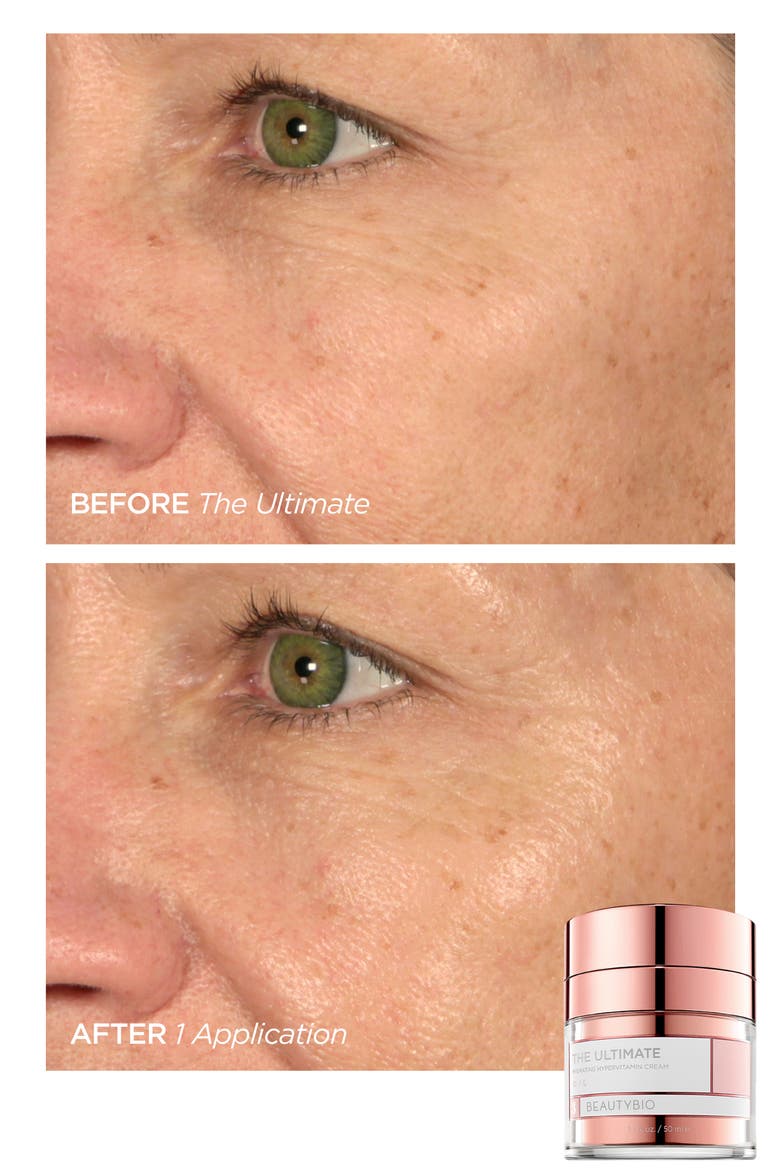 GloPRO® Microneedling Regeneration Facial Set (Nordstrom Exclusive), Alternate, color, NO COLOR