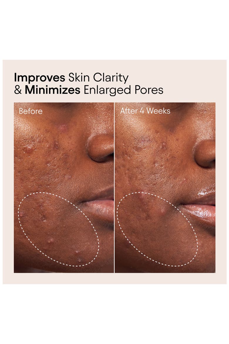 Pore Perfecting Liquid with 2% BHA & Borage, Alternate, color, NO COLOR