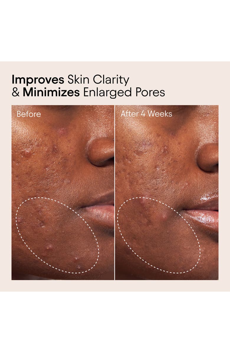 Alpyn Pore Perfecting Liquid with 2% BHA & Borage, Alternate, color, 