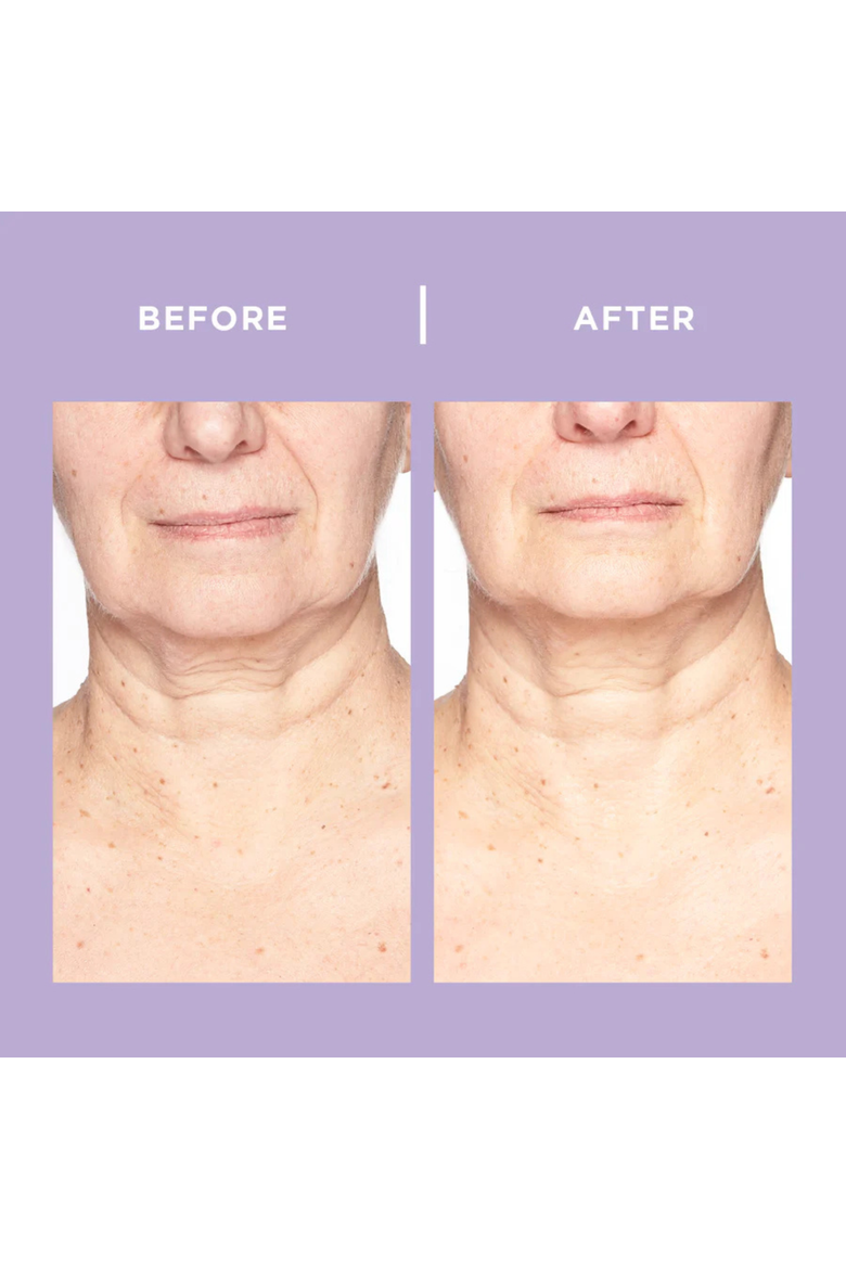 Ageless Throat & Decolletage Creme 50ml, Alternate, color, None