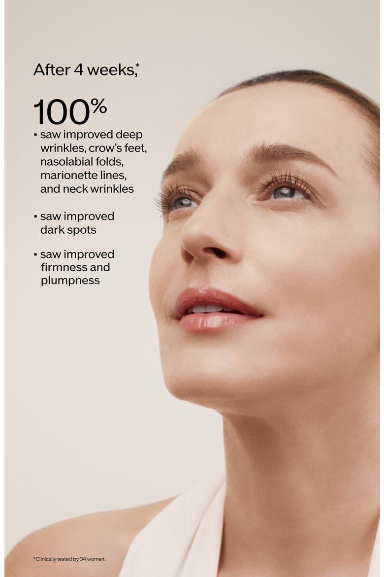 Vital Perfection Intensive WrinkleSpot Treatment A+, Alternate, color, NO COLOR