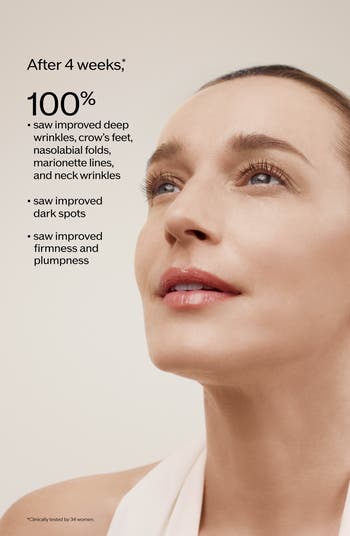 Vital Perfection Intensive WrinkleSpot Treatment A+