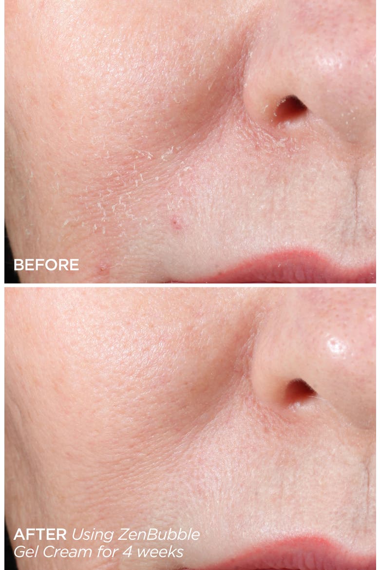Get That Glow GloPRO® Facial Microneedling Discovery Set $233 Value, Alternate, color, NO COLOR