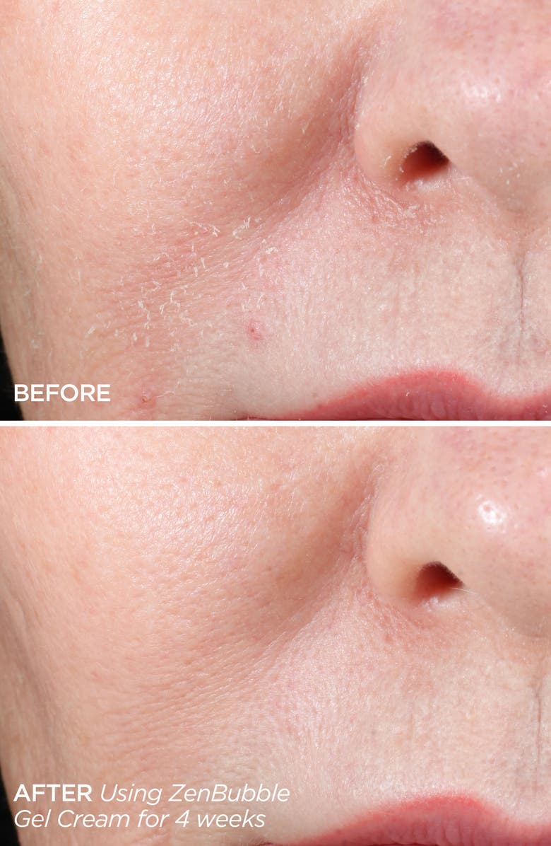 BeautyBio Get That Glow GloPRO<sup>®</sup> Facial Microneedling Discovery Set $233 Value, Alternate, color, 