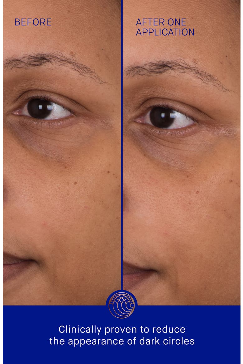 6-Pack The Eye Patches, Alternate, color, NO COLOR