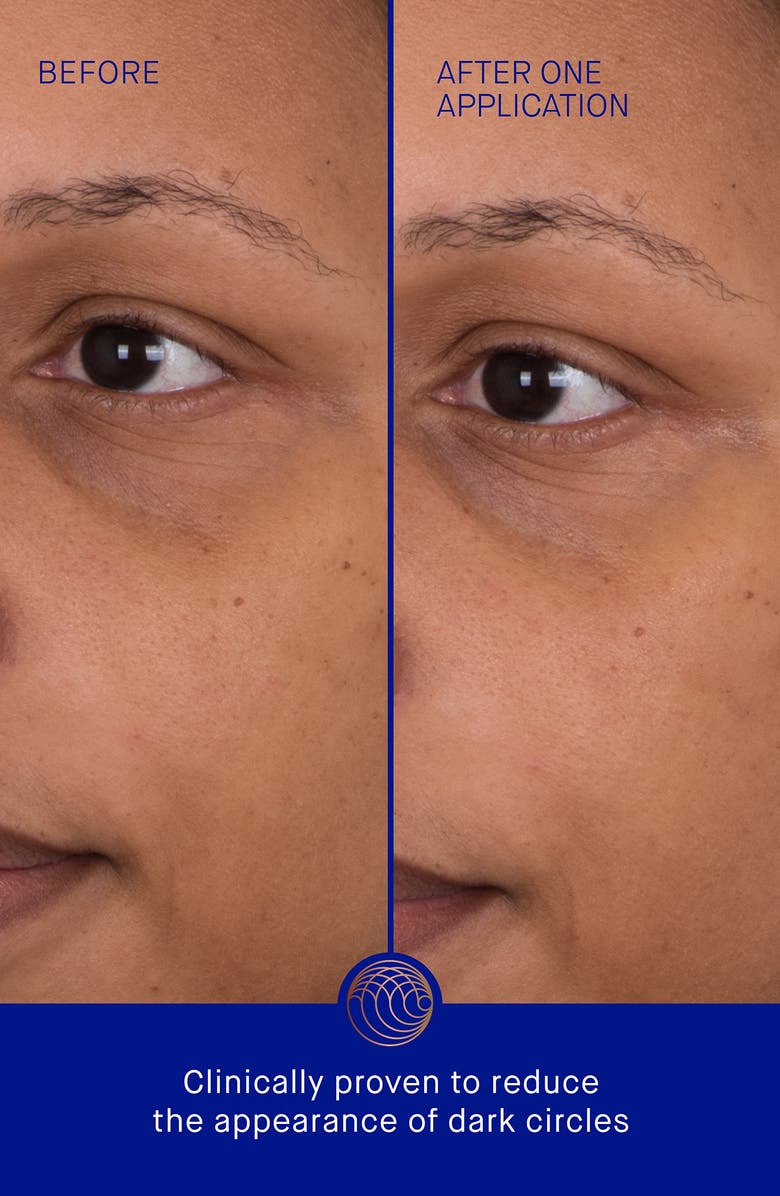 Augustinus Bader 6-Pack The Eye Patches, Alternate, color, 