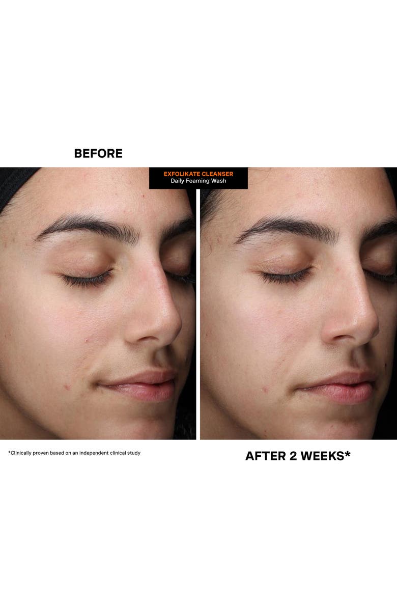 Kate Somerville<sup>®</sup> ExfoliKate<sup>®</sup> Cleanser Daily Foaming Wash, Alternate, color, 