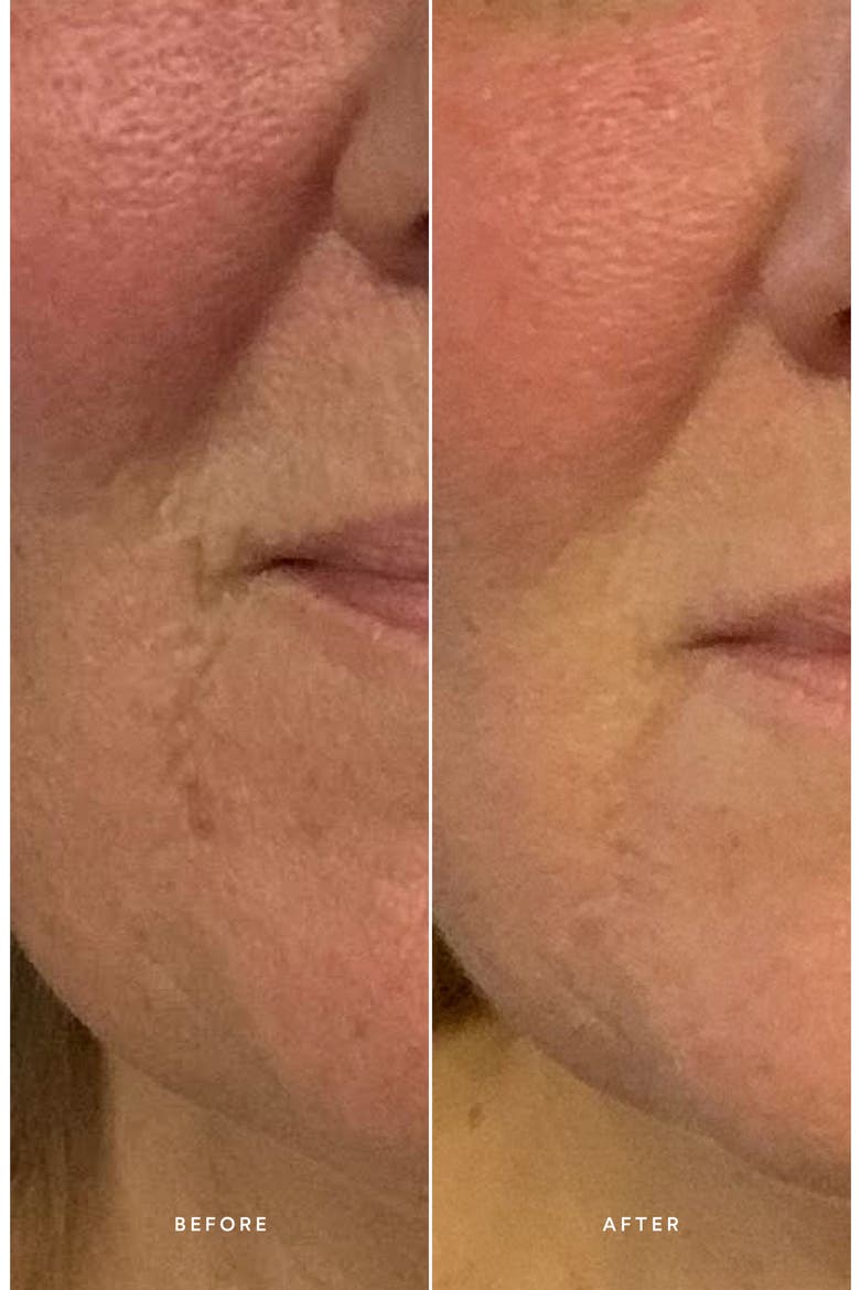 Renew Repair Serum, Alternate, color, NO COLOR