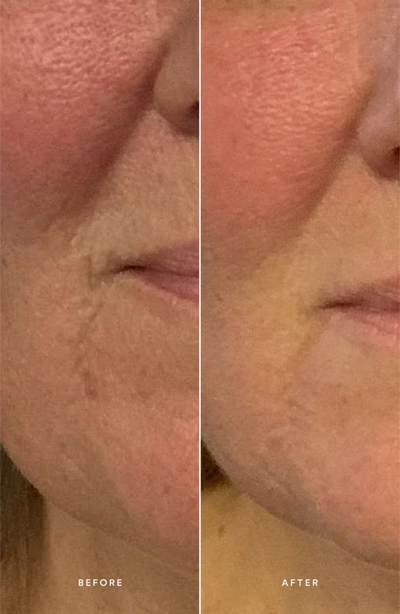 True Botanicals Renew Repair Serum, Alternate, color, 