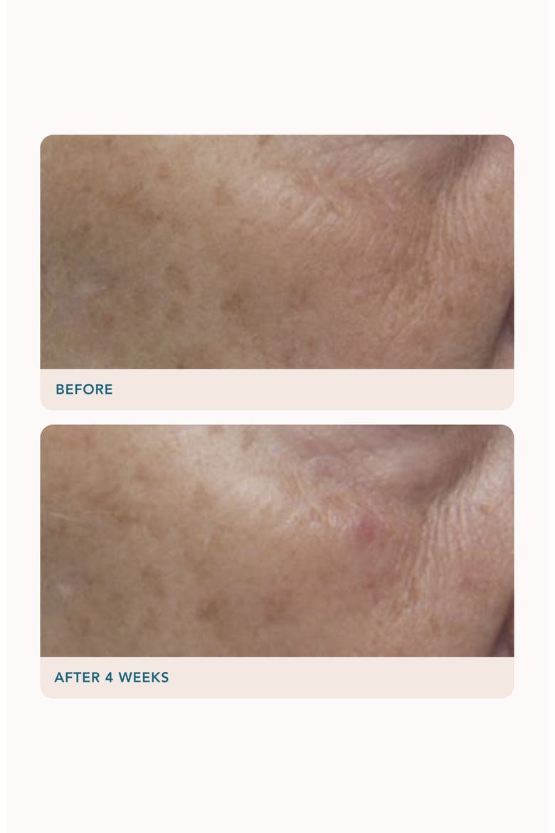 Dark Spot Correcting Serum, Alternate, color, NO COLOR