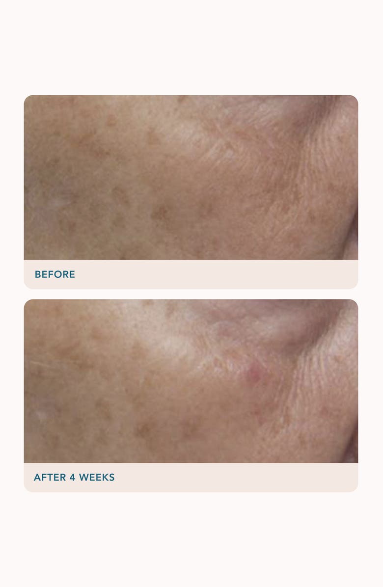 LANCER Skincare Dark Spot Correcting Serum, Alternate, color, 