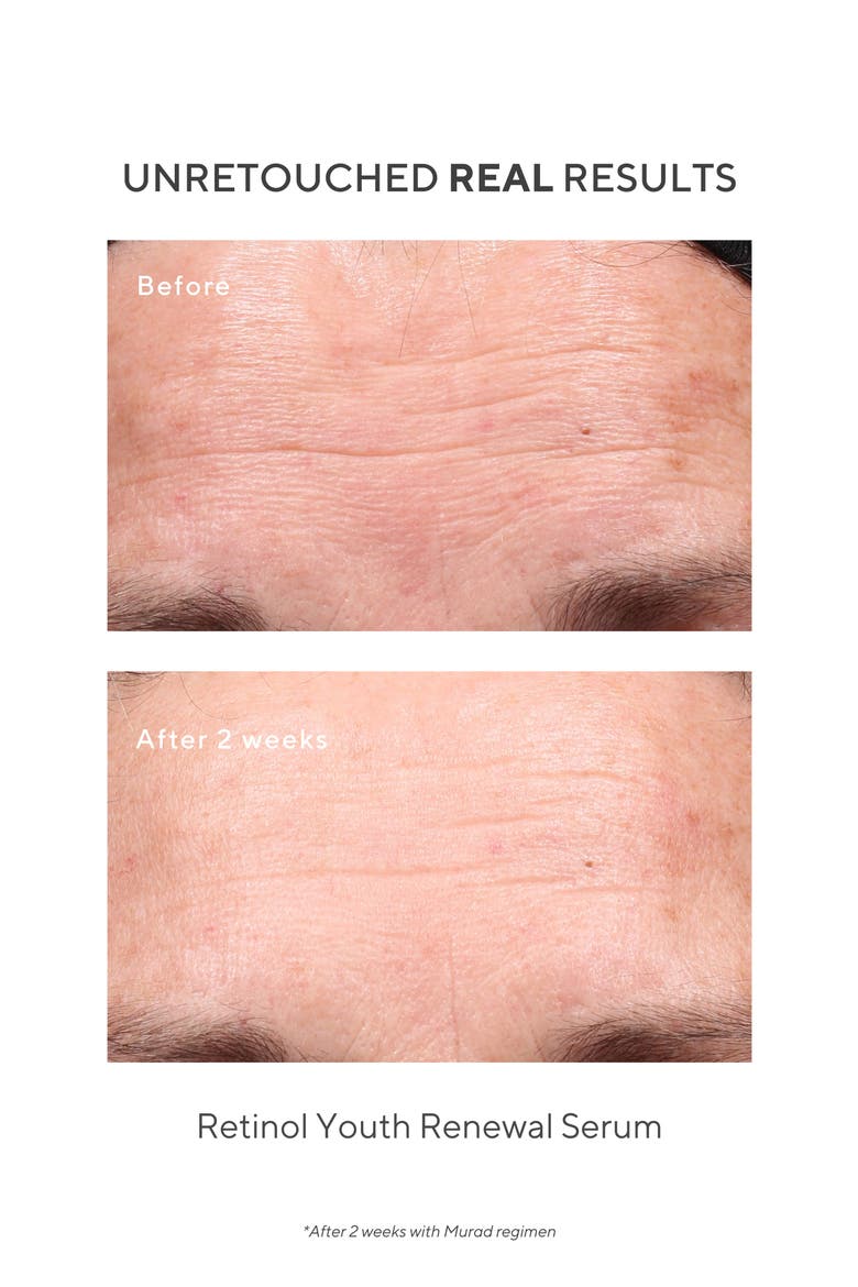 Retinol Youth Renewal Serum, Alternate, color, NO COLOR