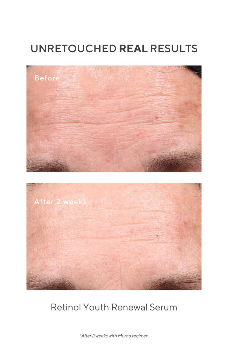 Murad<sup>®</sup> Retinol Youth Renewal Serum, Alternate, color,