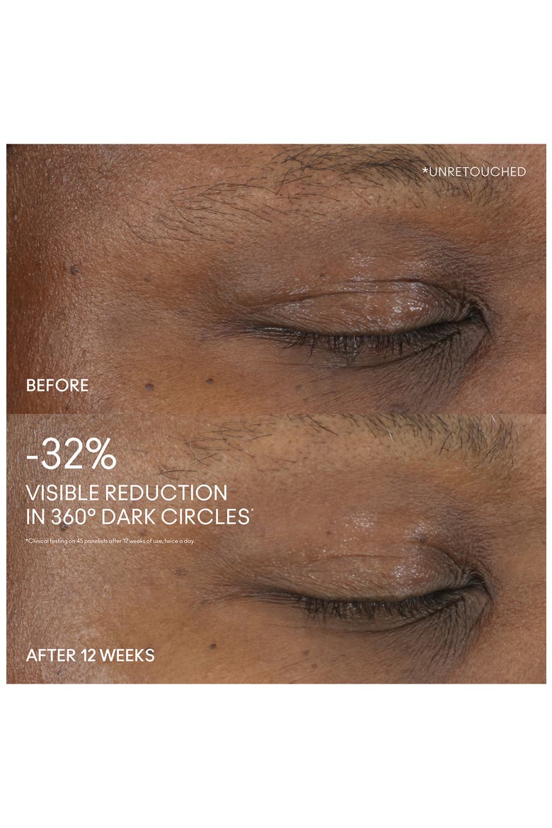 Hyper Real Serumizer™ Eye Treatment, Alternate, color, NONE