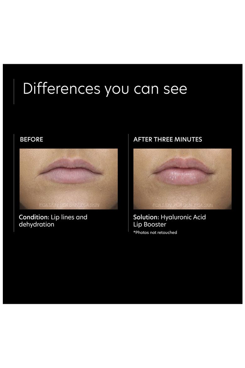 Hyaluronic Acid Lip Booster, Alternate, color, NO COLOR
