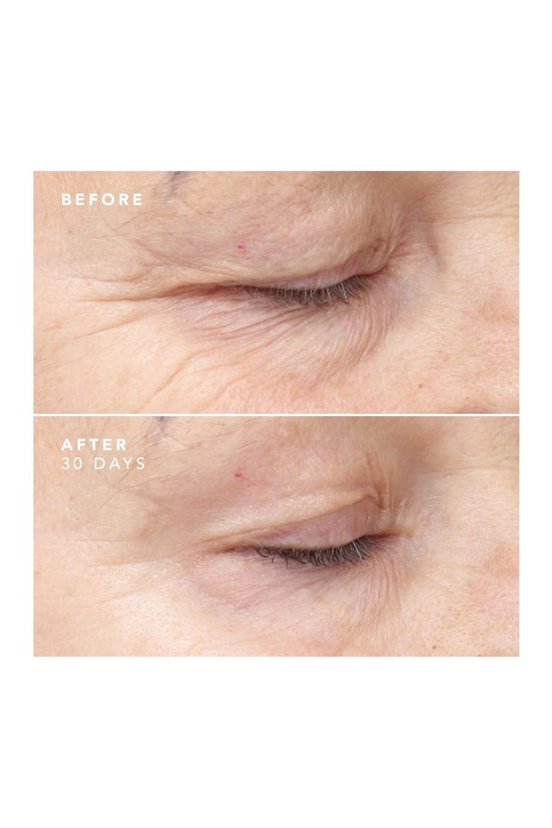 30 Day Treatment Intensive Anti-Aging Serum, Alternate, color, NO COLOR