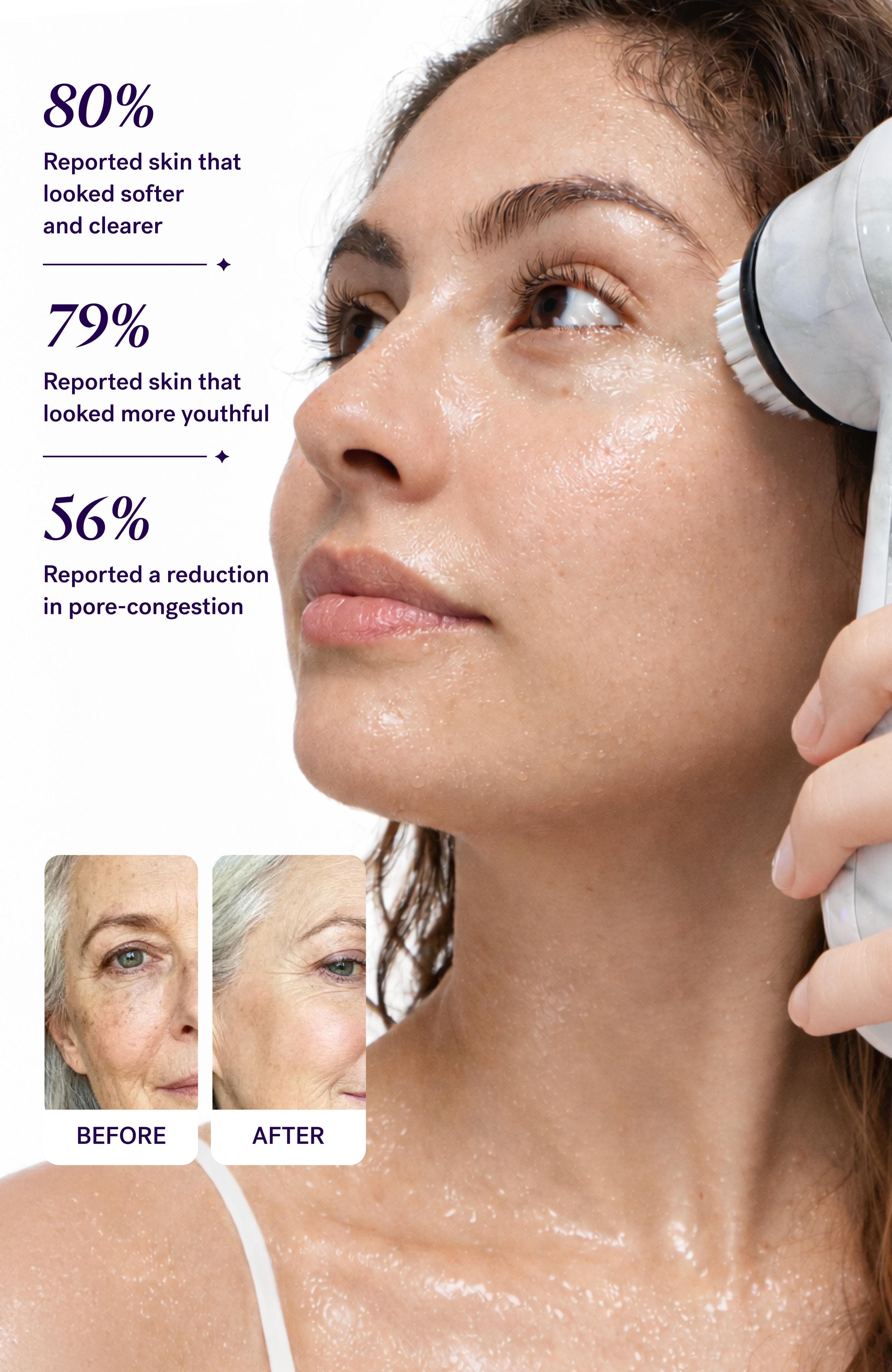 Soniclear Sonic Facial Cleansing Brush - Thumbnail 3