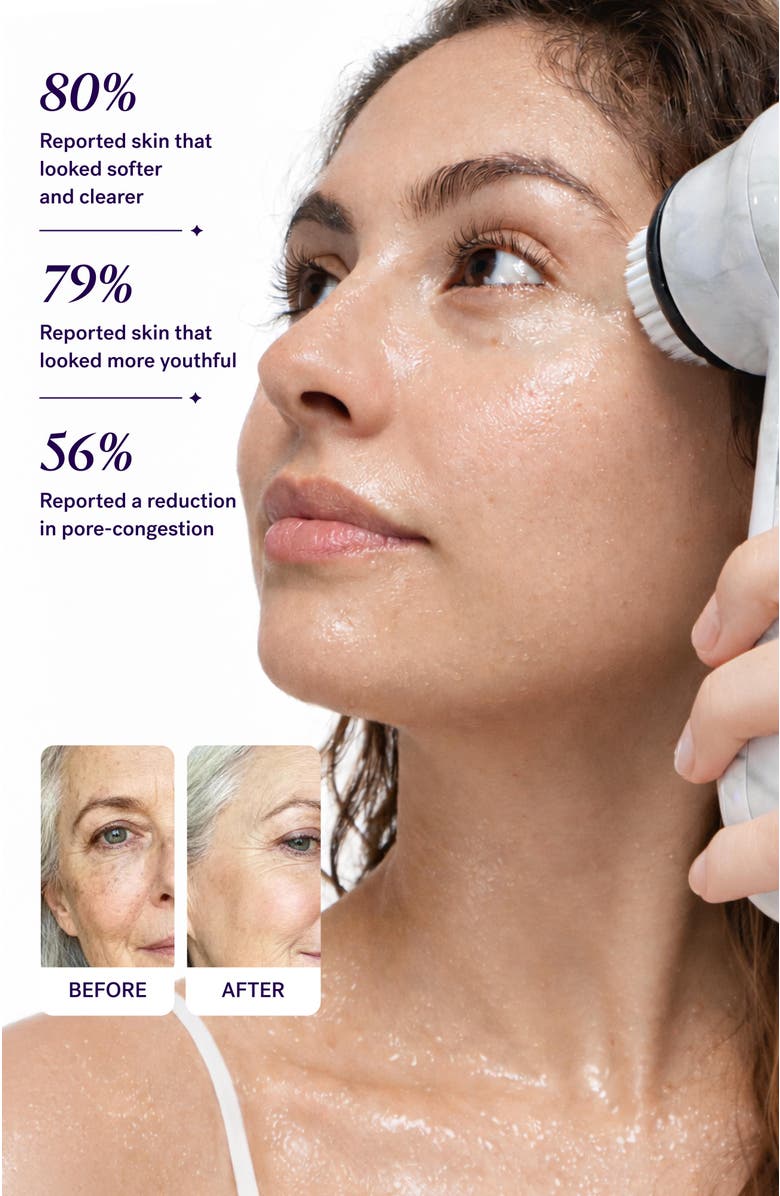 MICHAEL TODD BEAUTY Soniclear Sonic Facial Cleansing Brush, Alternate, color, Neutral, Balanced Color.