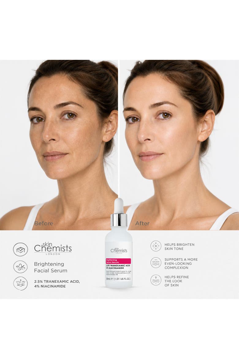 Brightening Tranexamic Acid 2.5%, Niacinamide 4% Facial Serum 30ml, Alternate, color, White