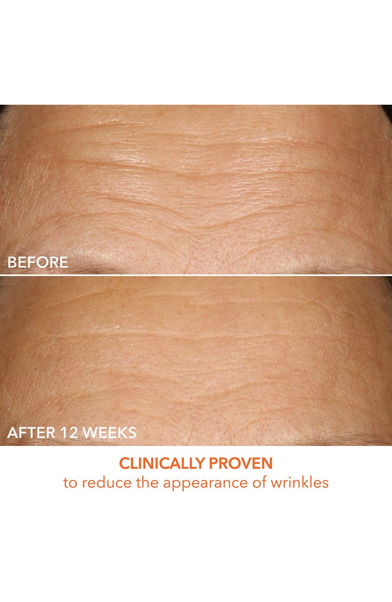 Dr. Dennis Gross Skincare Vitamin C Lactic 15% Firm & Bright Serum, Alternate, color, 