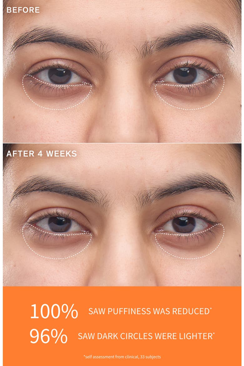 First Care Activating Eye Serum, Alternate, color, NO COLOR