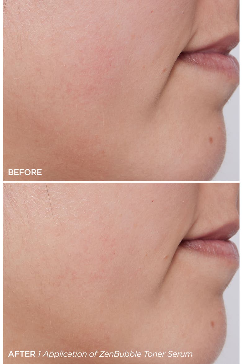 ZenBubble Bi-Phase Toner Serum, Alternate, color, NO COLOR